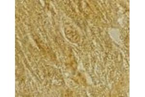 Immunohistochemistry of BACE2 in rat heart tissue with BACE2 antibody at 2 μg/ml. (BACE2 抗体  (C-Term))