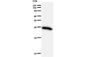 Western Blotting (WB) image for anti-Bromodomain and PHD Finger Containing, 1 (BRPF1) antibody (ABIN933002)