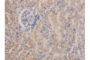 DAB staining on IHC-P; Samples: Rat Kidney Tissue (ALDH7A1 抗体  (AA 28-539))