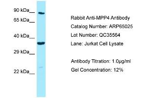 Western Blotting (WB) image for anti-Membrane Protein, Palmitoylated 4 (MAGUK P55 Subfamily Member 4) (MPP4) (C-Term) antibody (ABIN2790024) (MPP4 抗体  (C-Term))