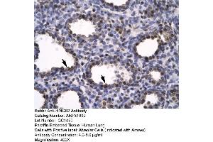 Human Lung (HMGB2 抗体  (C-Term))