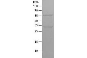 Western Blotting (WB) image for Ataxin 2-Like (ATXN2L) (AA 736-947) protein (His-IF2DI Tag) (ABIN7282161) (Ataxin 2-Like Protein (ATXN2L) (AA 736-947) (His-IF2DI Tag))