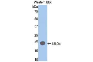 Western blot analysis of the recombinant protein. (Prothrombin 抗体  (AA 201-323))