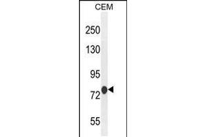 Western blot analysis in CEM cell line lysates (35ug/lane). (ATF7IP2 抗体  (AA 318-347))