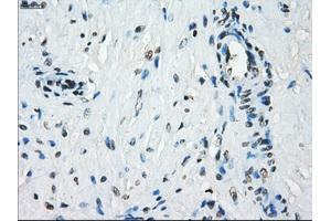 Immunohistochemical staining of paraffin-embedded Kidney tissue using anti-KDM4C mouse monoclonal antibody. (KDM4C 抗体)