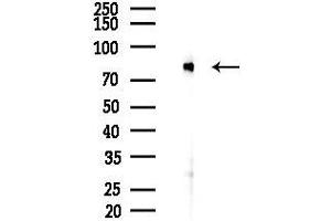 Western blot analysis of lysates from PC12 cells(LPS 4h treatment), using TNF Receptor II Antibody at 1/1000 dilution.
