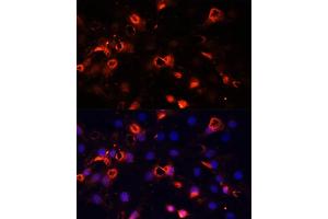 Immunofluorescence (IF) image for anti-Smoothened Homolog (Drosophila) (SMO) (AA 554-787) antibody (ABIN6148140)