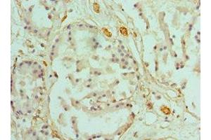 Immunohistochemistry of paraffin-embedded human prostate tissue using ABIN7146462 at dilution of 1:100 (Caldesmon 抗体  (AA 1-240))