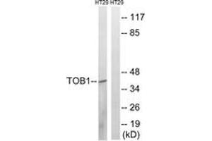 Western blot analysis of extracts from HT29 cells treated with serum 20% 15', using TOB1 (Phospho-Ser164) Antibody. (Protein Tob1 (TOB1) (AA 130-179), (pSer164) 抗体)