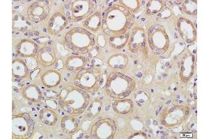 Formalin-fixed and paraffin embedded human kidney labeled with Rabbit Anti-AQP5 Polyclonal Antibody, Unconjugated  at 1:200 followed by conjugation to the secondary antibody and DAB staining (Aquaporin 5 抗体  (AA 201-265))