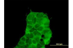 Immunofluorescence of purified MaxPab antibody to CHD9 on 293 cell. (CHD9 抗体  (AA 1-119))