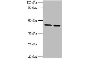 Western blot analysis of Jurkat whole cell lysate (Lane 1) and Rat liver tissue (Lane 2) with CHRFAM7A Antibody (3 ug/ml) and Goat Anti-Rabbit polyclonal antibody (1/10000 dilution). (CHRFAM7A 抗体  (AA 1-150))