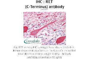 Image no. 1 for anti-Ret Proto-Oncogene (RET) (C-Term) antibody (ABIN5693697) (Ret Proto-Oncogene 抗体  (C-Term))