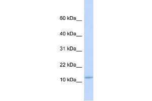 C9ORF46 antibody used at 1 ug/ml to detect target protein. (PLGRKT 抗体  (Middle Region))