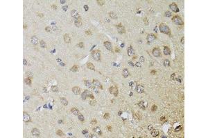 Immunohistochemistry of paraffin-embedded Rat brain using CHN1 Polyclonal Antibody at dilution of 1:100 (40x lens). (CHN1 抗体)