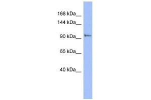 PI4KB antibody used at 1 ug/ml to detect target protein.