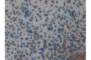 Detection of ANXA2 in Mouse Uterus Tissue using Polyclonal Antibody to Annexin A2 (ANXA2) (Annexin A2 抗体  (AA 1-339))
