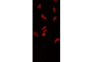 ABIN6268871 staining PC-12 cells by IF/ICC.