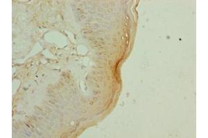 Immunohistochemistry of paraffin-embedded human skin tissue using ABIN7152281 at dilution of 1:100 (EXOSC1 抗体  (AA 9-195))