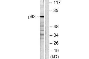 Western Blotting (WB) image for anti-T-Complex 1 (TCP1) (C-Term) antibody (ABIN1848722) (TCP1 alpha/CCTA 抗体  (C-Term))