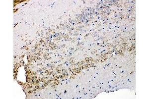 IHC-P: Syndecan 3 antibody testing of rat brain tissue (SDC3 抗体  (N-Term))