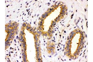 Immunohistochemistry (IHC) image for anti-Chaperonin Containing TCP1, Subunit 8 (Theta) (CCT8) (AA 421-548) antibody (ABIN4886516)