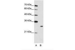 Image no. 1 for anti-Muscleblind-like Protein 1 (MBNL1) (C-Term) antibody (ABIN202283) (MBNL1 抗体  (C-Term))