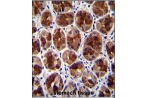Immunohistochemistry analysis in Formalin Fixed, Paraffin Embedded Human stomach tissue stained with SERTAD4 antibody (C-term) followed by peroxidase conjugation of the secondary antibody and DAB staining. (SERTAD4 抗体  (C-Term))