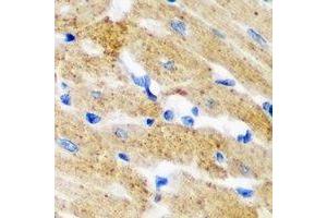 Immunohistochemical analysis of HNMT staining in mouse heart formalin fixed paraffin embedded tissue section. (HNMT 抗体)