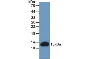 Detection of Recombinant FABP1, Human using Monoclonal Antibody to Fatty Acid Binding Protein 1 (FABP1) (FABP1 抗体  (AA 2-127))