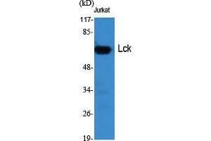 Western Blot (WB) analysis of specific cells using Lck Polyclonal Antibody.