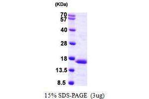 SDS-PAGE (SDS) image for Prefoldin Subunit 6 (PFDN6) (AA 1-129) protein (His tag) (ABIN667890) (PFDN6 Protein (AA 1-129) (His tag))