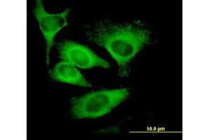 Image no. 1 for anti-Eukaryotic Translation Initiation Factor 5 (EIF5) (AA 1-432) antibody (ABIN598657) (EIF5 抗体  (AA 1-432))