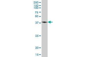 ACTB monoclonal antibody (M03), clone 1E7. (beta Actin 抗体  (AA 1-375))