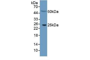 Mouse Capture antibody from the kit in WB with Positive Control: Human serum. (CRP ELISA 试剂盒)