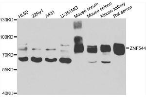 Western blot analysis of extracts of various cell lines, using ZNF544 antibody. (ZNF544 抗体)