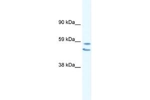 WB Suggested Anti-EGR2 Antibody Titration:  0.
