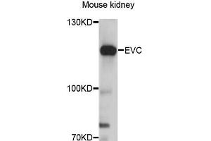 Western blot analysis of extracts of mouse kidney, using EVC antibody (ABIN6290358) at 1:3000 dilution. (EVC 抗体)