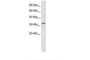 Image no. 2 for anti-Zinc Finger Protein 134 (ZNF134) (AA 128-177) antibody (ABIN203066) (ZNF134 抗体  (AA 128-177))