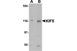 Western Blotting (WB) image for anti-Kinesin Family Member 5A (KIF5A) (C-Term) antibody (ABIN1030467)