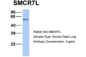 Host:  Rabbit  Target Name:  SMCR7L  Sample Type:  Human Fetal Lung  Antibody Dilution:  1. (SMCR7L 抗体  (N-Term))