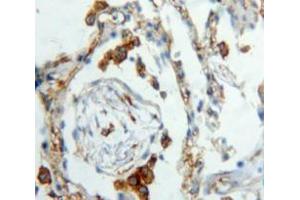 IHC-P analysis of Lung tissue, with DAB staining. (XCL1 抗体  (AA 23-113))