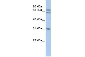 Gephyrin antibody used at 1 ug/ml to detect target protein. (Gephyrin 抗体  (Middle Region))