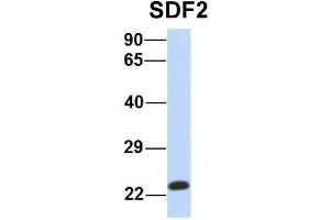 Host:  Rabbit  Target Name:  SDF2  Sample Type:  Human MCF7  Antibody Dilution:  1. (SDF2 抗体  (Middle Region))