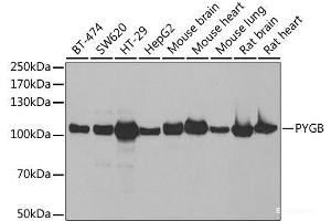 Western blot analysis of extracts of various cell lines using PYGB Polyclonal Antibody at dilution of 1:1000. (PYGB 抗体)