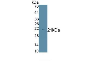 Detection of Recombinant Hpt, Human using Monoclonal Antibody to Haptoglobin (Hpt) (Haptoglobin 抗体  (AA 168-319))