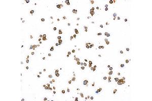 Immunocytochemistry (ICC) image for anti-Carcinoembryonic Antigen-Related Cell Adhesion Molecule 1/5 (CEACAM1/5) (AA 35-433) antibody (ABIN7455139) (Recombinant CEACAM1/5 抗体  (AA 35-433))