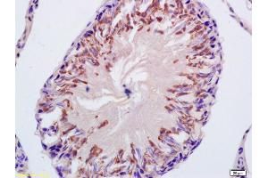 Immunohistochemistry (IHC) image for anti-Cytochrome P450, Family 21, Subfamily A, Polypeptide 2 (CYP21A2) (AA 101-200) antibody (ABIN740355)