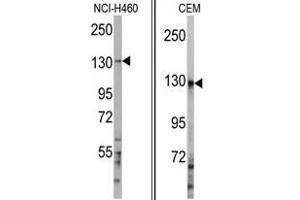 Image no. 1 for anti-Ubiquitination Factor E4A (UBE4A) (C-Term) antibody (ABIN357482) (UBE4A 抗体  (C-Term))