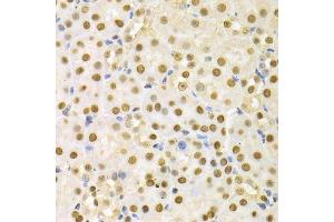 Immunohistochemistry of paraffin-embedded mouse kidney using SFN Antibody. (14-3-3 sigma/SFN 抗体  (AA 1-248))